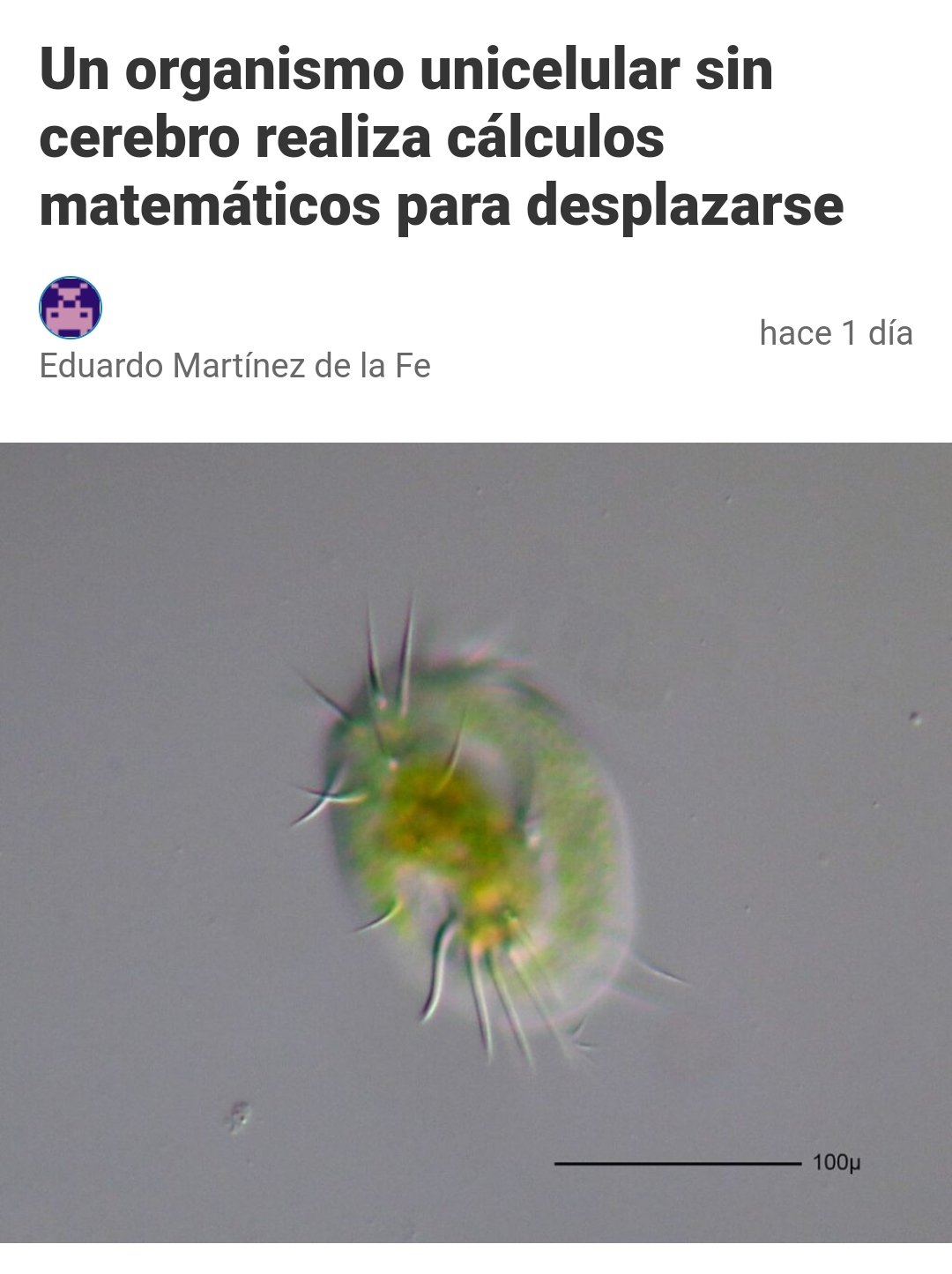 La Noticia Mi Cabeza
