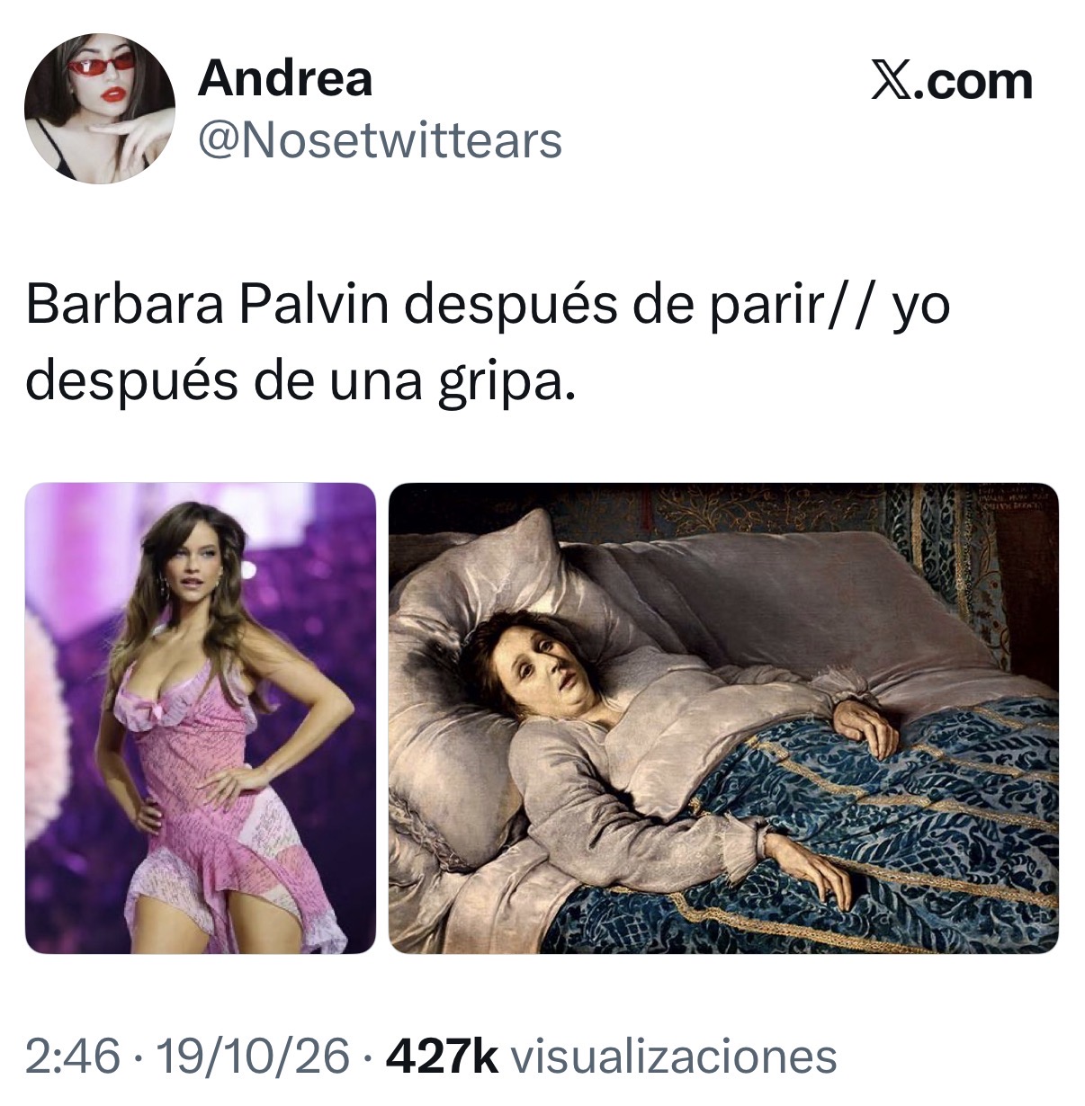 Tuit de Nosetwittears: Barbara Palvin después de parir // yo después de una gripa